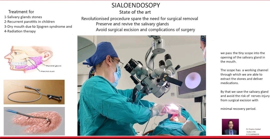 Sialoendoscopy procedure — minimally invasive salivary gland treatment